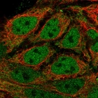 Immunofluorescent staining of human cell line CACO-2 shows localization to nucleoplasm & cytosol.