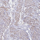 Anti-MYL6 Antibody