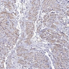 Anti-MYL6 Antibody