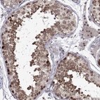 Anti-EFCAB3 Antibody