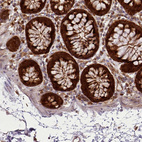 Anti-LGALS9 Antibody