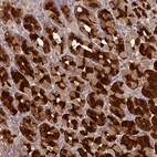 Immunohistochemical staining of human stomach shows strong cytoplasmic positivity in glandular cells.