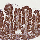 Anti-LGALS9 Antibody