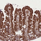 Immunohistochemical staining of human small intestine shows moderate to strong cytoplasmic positivity in glandular cells.