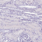 Immunohistochemical staining of human kidney shows no positivity in cells in tubules as expected.