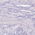 Immunohistochemical staining of human kidney shows no positivity in cells in tubules as expected.