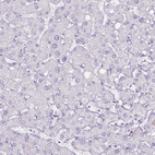 Immunohistochemical staining of human liver shows no positivity in hepatocytes as expected.