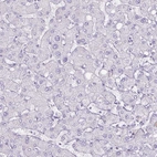 Immunohistochemical staining of human liver shows no positivity in hepatocytes as expected.
