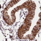Immunohistochemical staining of human fallopian tube shows moderate to strong cytoplasmic positivity in glandular cells.