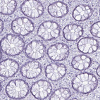 Immunohistochemical staining of human colon shows no positivity in glandular cells as expected.