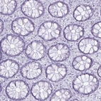 Immunohistochemical staining of human colon shows no positivity in glandular cells as expected.