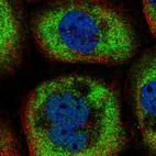 Immunofluorescent staining of human cell line A-431 shows localization to cytosol.
