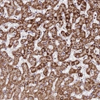 Anti-OR51T1 Antibody