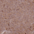 Anti-C2CD4B Antibody