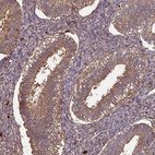 Immunohistochemical staining of human endometrium shows moderate cytoplasmic positivity in glandular cells.