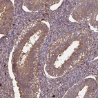 Immunohistochemical staining of human endometrium shows moderate cytoplasmic positivity in glandular cells.