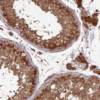 Immunohistochemical staining of human testis shows strong cytoplasmic positivity in leydig cells and cells in seminiferous ducts.