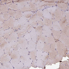 Immunohistochemical staining of human skeletal muscle shows very weak positivity in myocytes as expected.