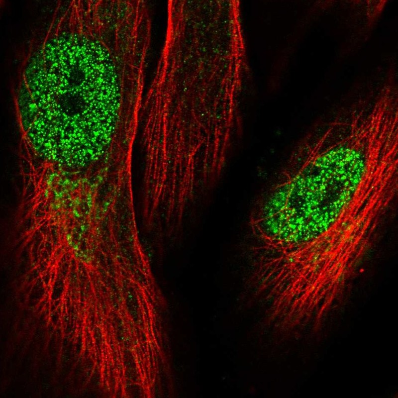 Anti-KRBOX1 Antibody