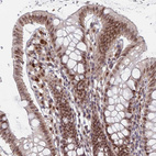 Anti-RPP25 Antibody