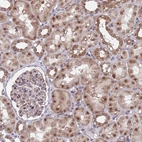 Immunohistochemical staining of human kidney shows weak to moderate nuclear positivity in cells in tubules.