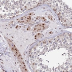 Immunohistochemical staining of human testis shows moderate nuclear positivity in Leydig cells.