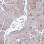 Immunohistochemical staining of human skeletal muscle shows no nuclear positivity in myocytes.