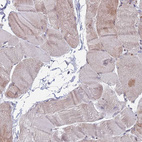 Anti-RPP25 Antibody