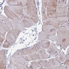 Immunohistochemical staining of human skeletal muscle shows no nuclear positivity in myocytes.