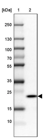 Lane 1: Marker [kDa] 250, 130, 100, 70, 55, 35, 25, 15, 10_br/_Lane 2: Human cell line SK-MEL-30