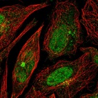 Immunofluorescent staining of human cell line SiHa shows localization to nucleoplasm & microtubule organizing center.