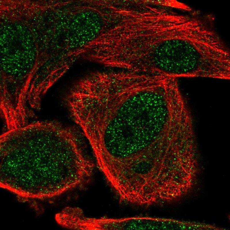 Anti-COMMD5 Antibody