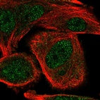 Anti-COMMD5 Antibody