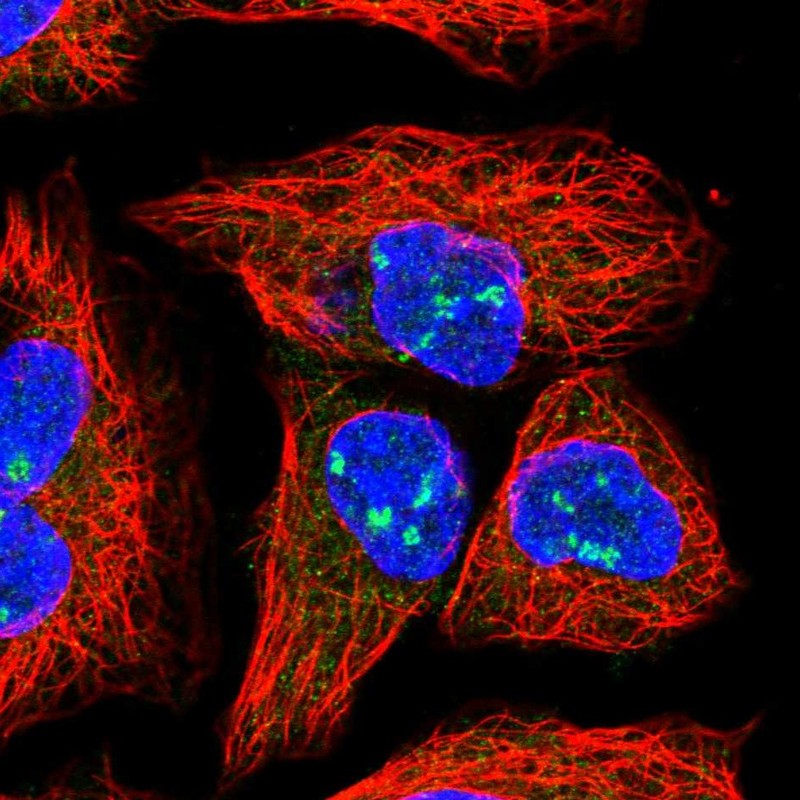 Anti-HEATR1 Antibody