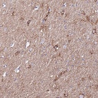 Anti-JAKMIP2 Antibody