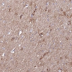 Anti-JAKMIP2 Antibody
