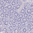 Immunohistochemical staining of human duodenum shows no positivity in glandular cells as expected.