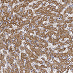 Immunohistochemical staining of human liver shows strong granular cytoplasmic positivity in hepatocytes.