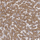 Immunohistochemical staining of human liver shows strong granular cytoplasmic positivity in hepatocytes.