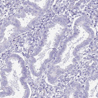 Immunohistochemical staining of human endometrium shows no positivity in glandular cells as expected.