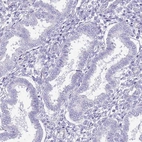 Immunohistochemical staining of human endometrium shows no positivity in glandular cells as expected.