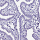 Immunohistochemical staining of human fallopian tube shows no positivity in glandular cells as expected.