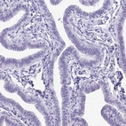 Immunohistochemical staining of human fallopian tube shows no positivity in glandular cells as expected.
