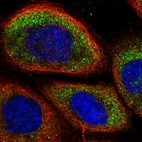 Immunofluorescent staining of human cell line A-431 shows localization to cytosol.
