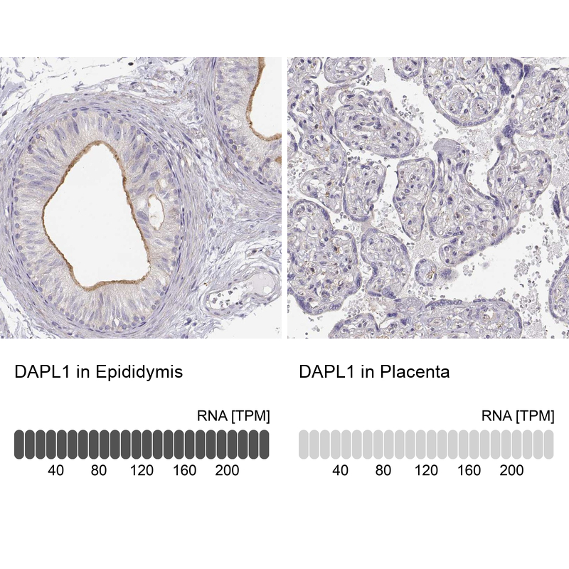 Anti-DAPL1 Antibody