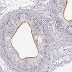Immunohistochemical staining of human epididymis shows high expression.