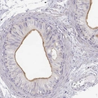 Immunohistochemical staining of human epididymis shows high expression.