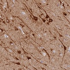 Anti-MCCD1 Antibody