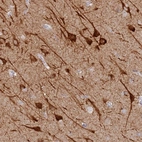 Anti-MCCD1 Antibody