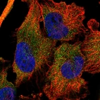Immunofluorescent staining of human cell line U-251 MG shows localization to cytosol.